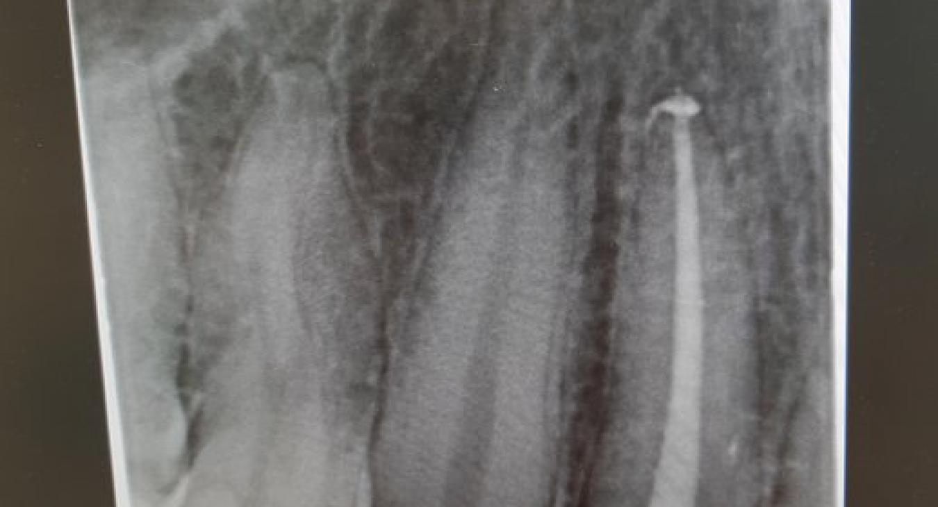 Endodoncja